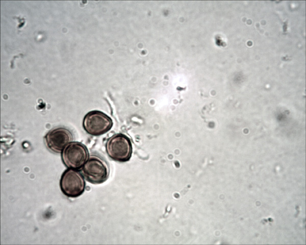 Perenniporia fraxinea (Bull)Ryvarden