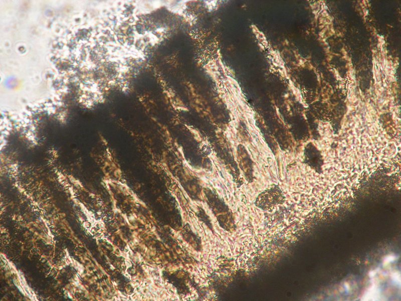 Diploschistes: da determinare