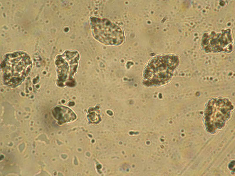 Diploschistes: da determinare