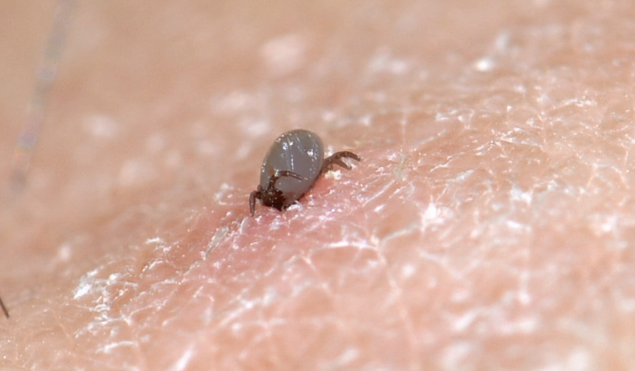 Zecca azzeccata