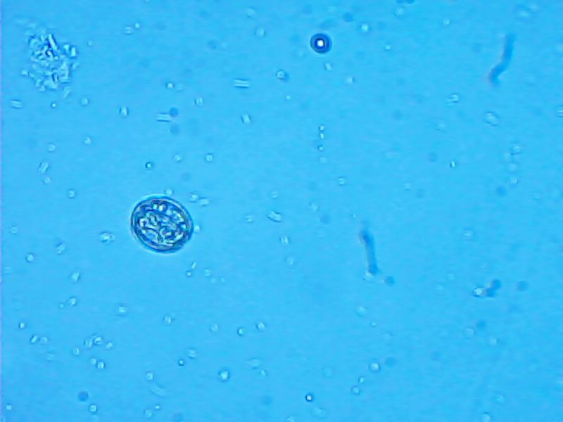 Giardia?