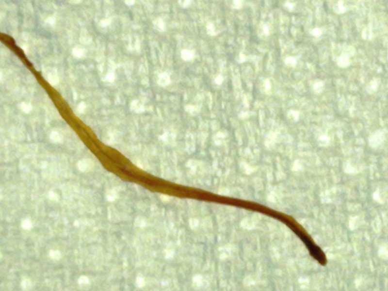 Nematode da identificare