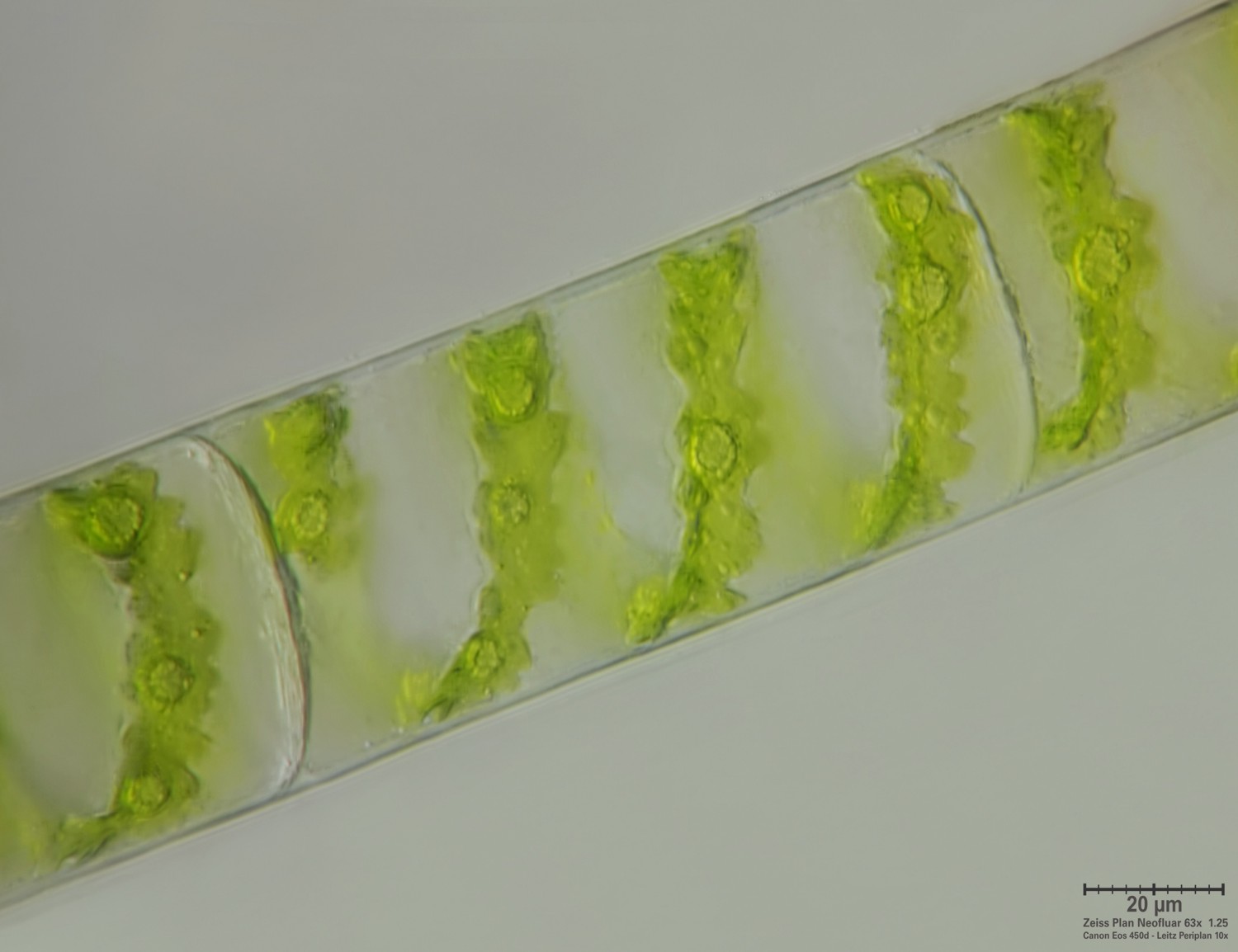 Spyrogira sp.