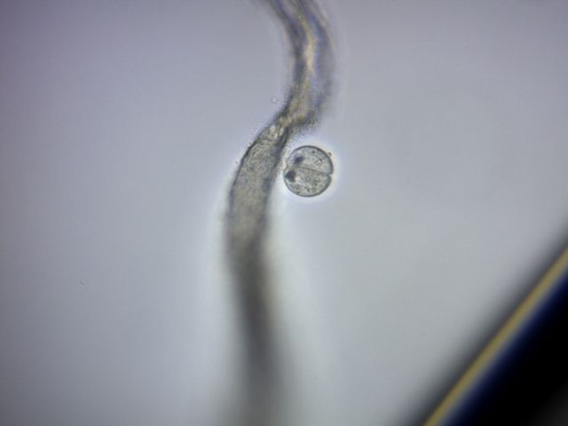 Colpoda cucullus -duplicazione-