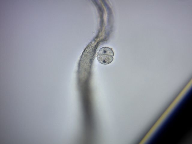 Colpoda cucullus -duplicazione-