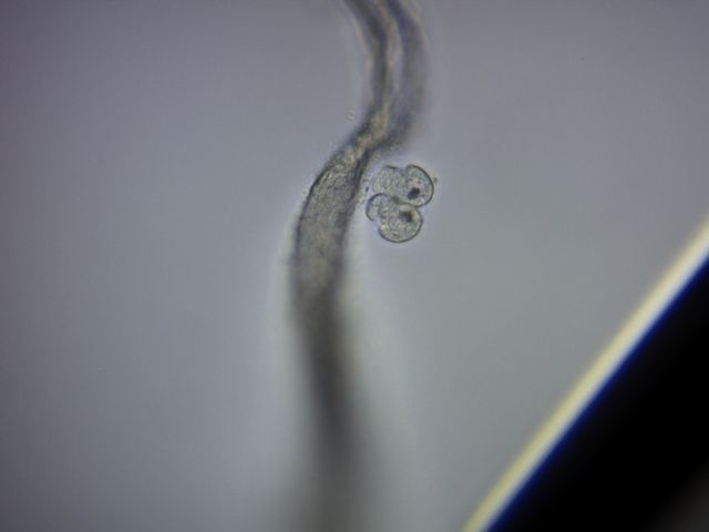 Colpoda cucullus -duplicazione-
