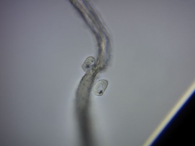Colpoda cucullus -duplicazione-