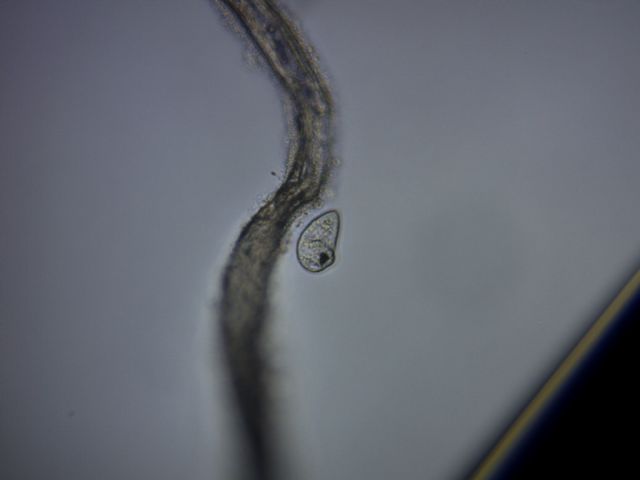 Colpoda cucullus -duplicazione-