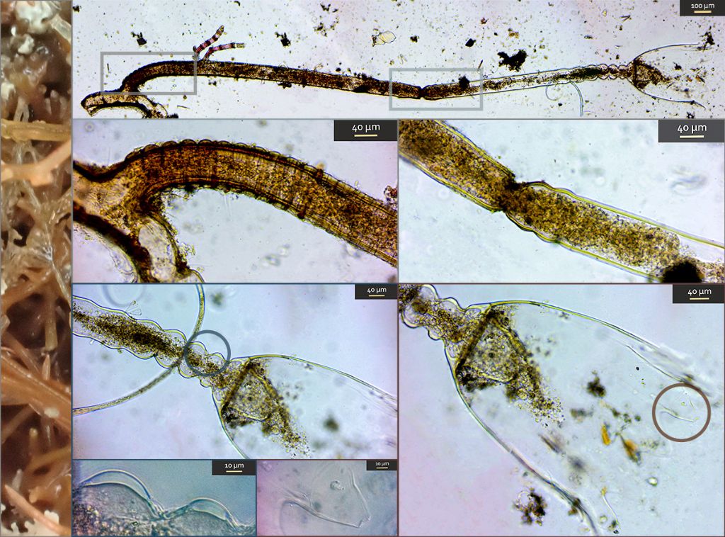 Idrozoi ?