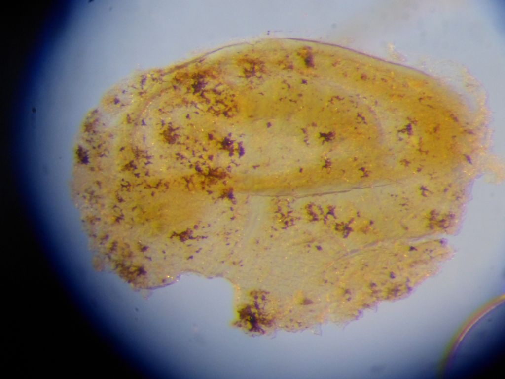 Bithyniidae vs Hydrobiidae