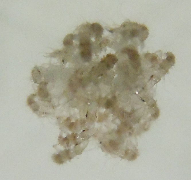 Neanidi di Chrysopidae? S, larve da ovatura di Pseudomallada sp.