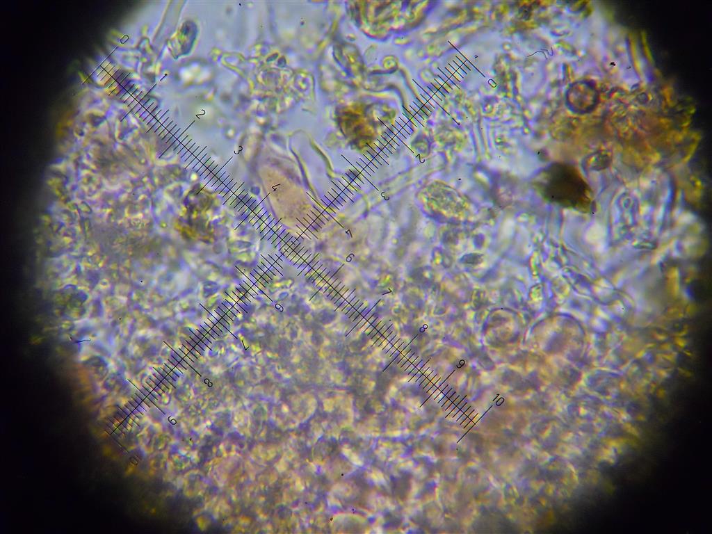 Ancora Corticium meridioroseum? (Corticium meridioroseum)
