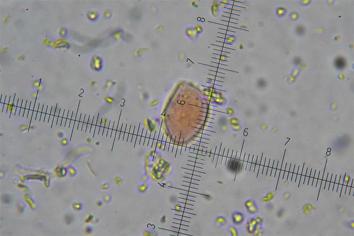 Ancora Corticium meridioroseum? (Corticium meridioroseum)