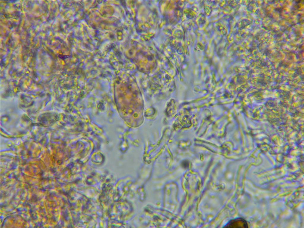Ancora Corticium meridioroseum? (Corticium meridioroseum)