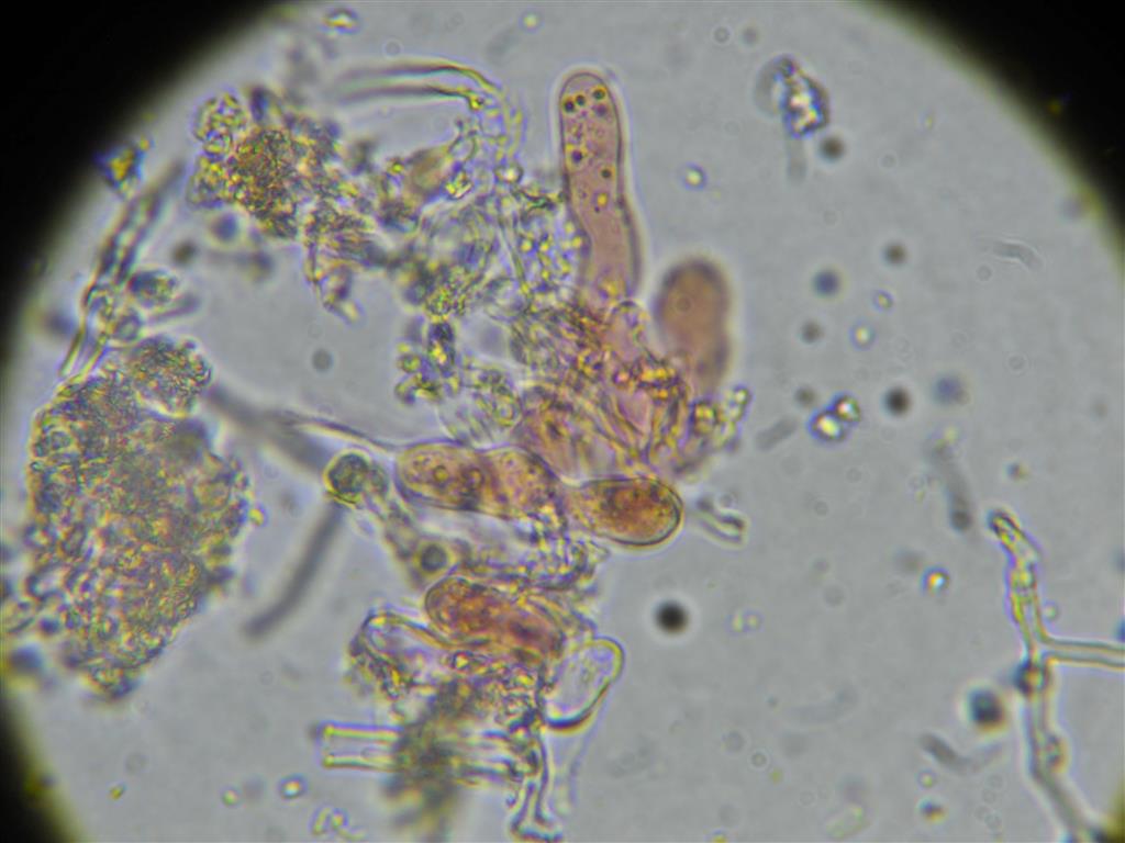 Ancora Corticium meridioroseum? (Corticium meridioroseum)