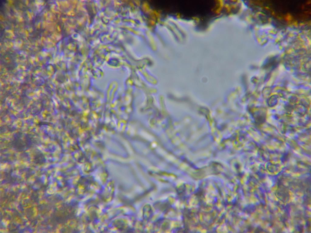Ancora Corticium meridioroseum? (Corticium meridioroseum)