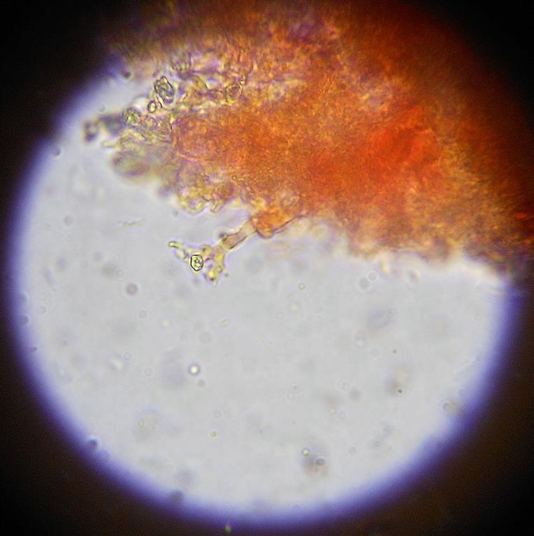 Ancora Corticium meridioroseum? (Corticium meridioroseum)