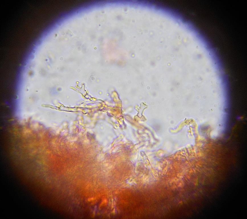 Ancora Corticium meridioroseum? (Corticium meridioroseum)