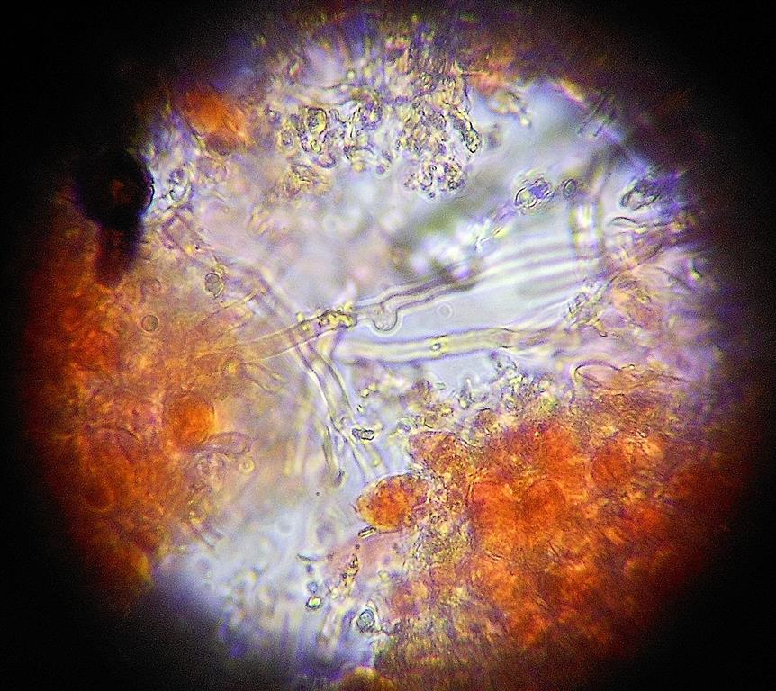 Ancora Corticium meridioroseum? (Corticium meridioroseum)