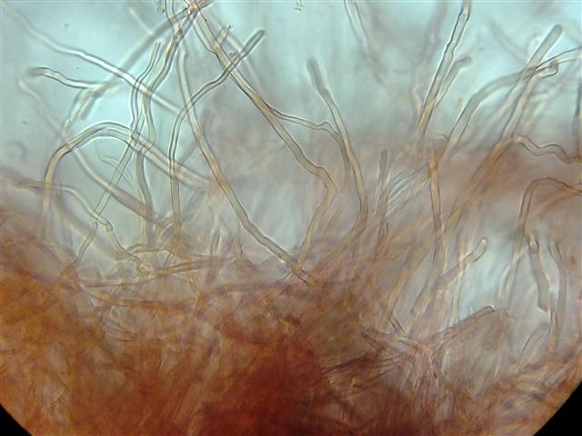 Steccherinum ochraceum? (Steccherinum bourdotii)