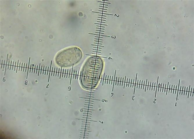 Peniophora incarnata?
