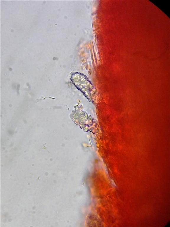 Steccherinum ochraceum? (Steccherinum bourdotii)