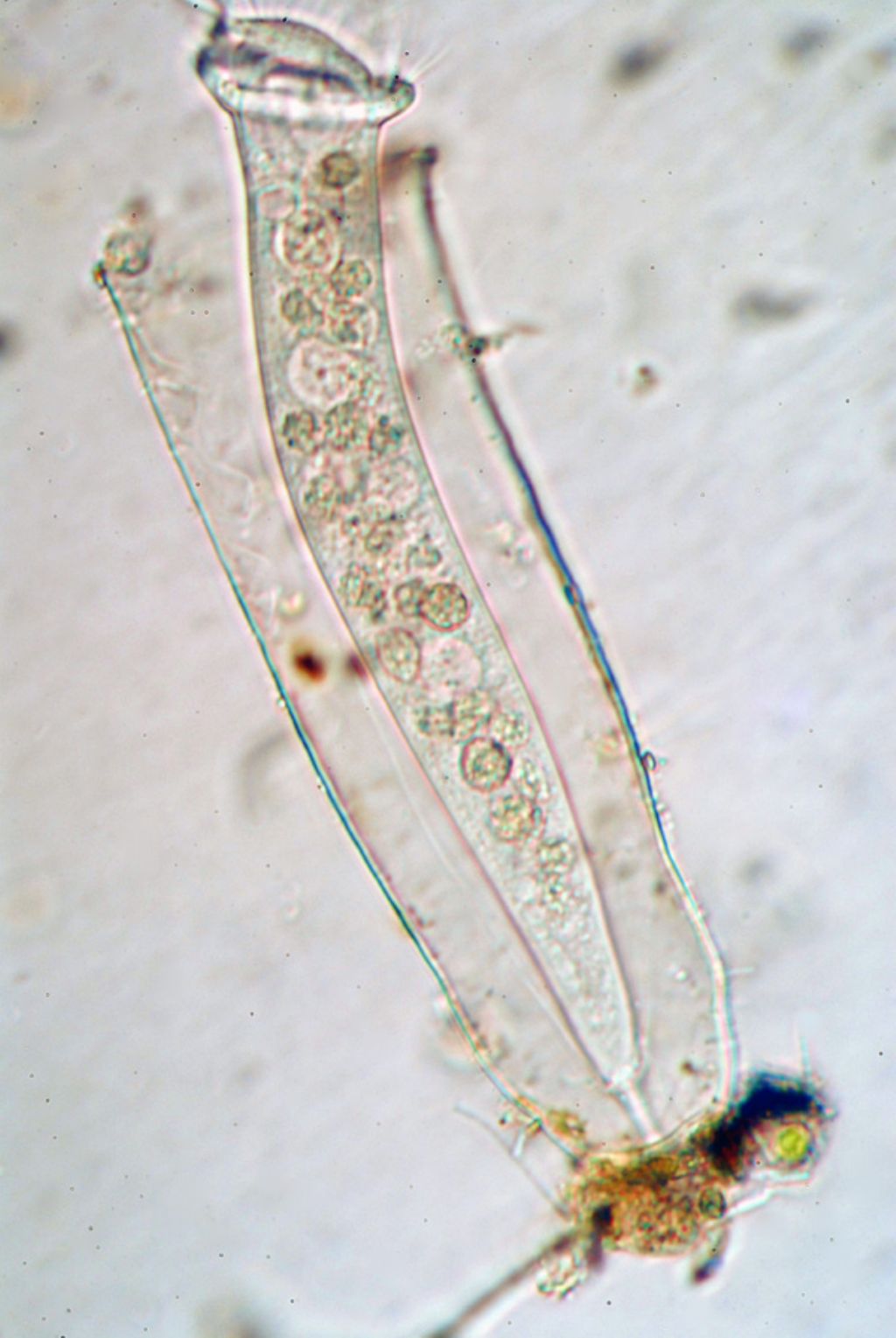 Vaginicula