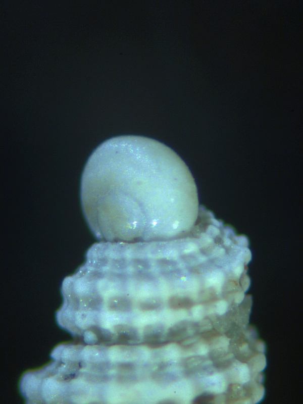 gasteropode II
