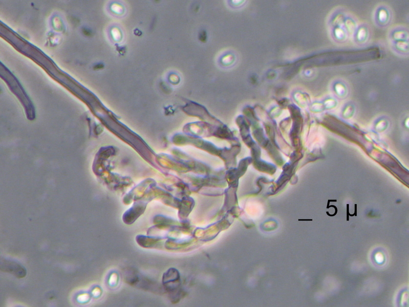 Strana polyporacea cresciuta a Mongrando (BI)