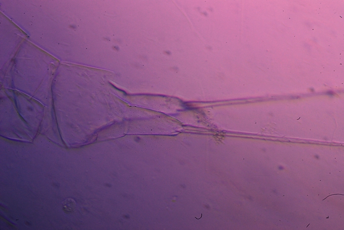 Cosa sono questi ? Copepode?