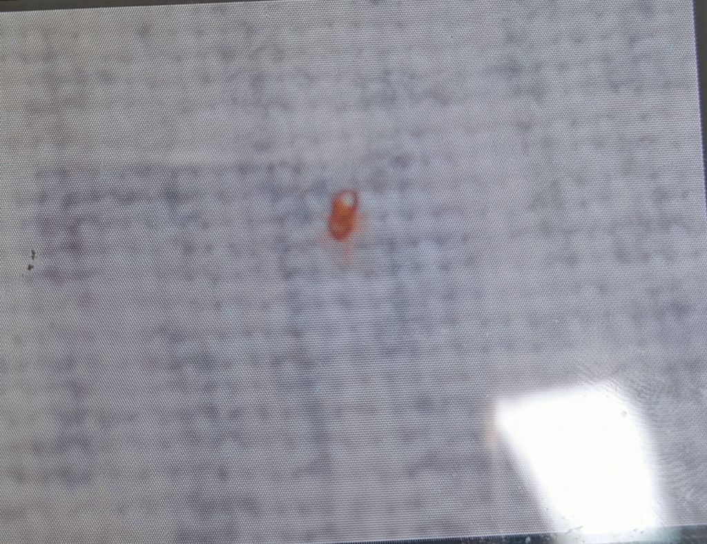 Insetti piccolissimi marroni che camminano sul cuscino
