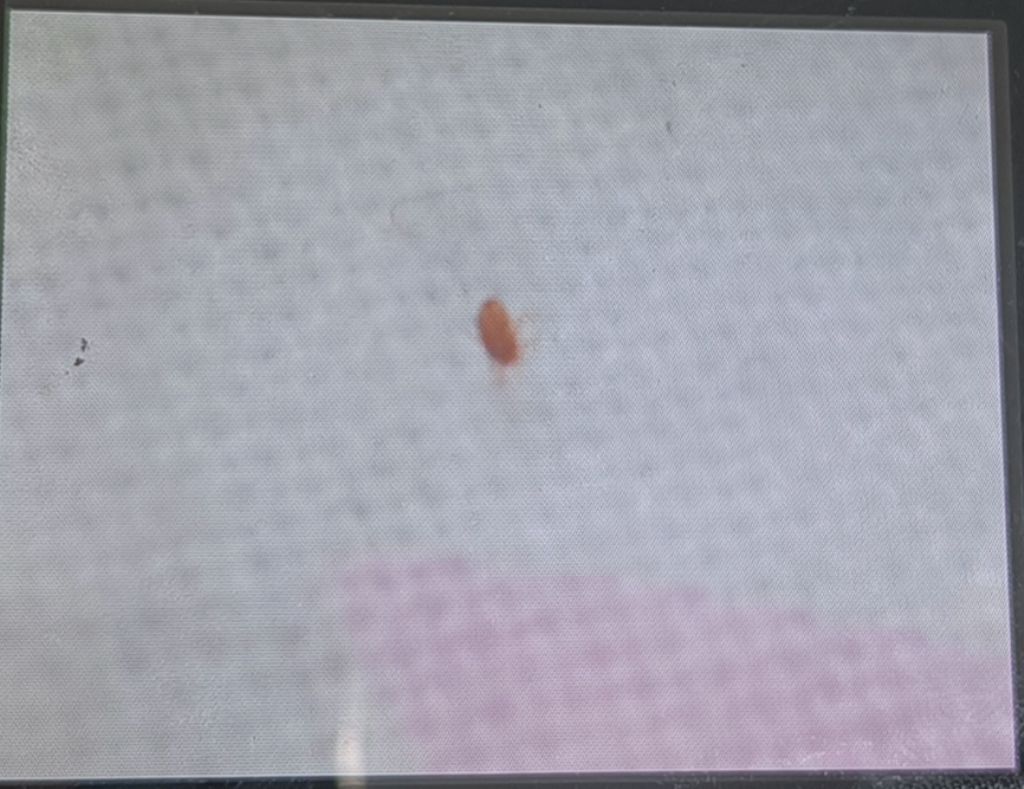 Insetti piccolissimi marroni che camminano sul cuscino