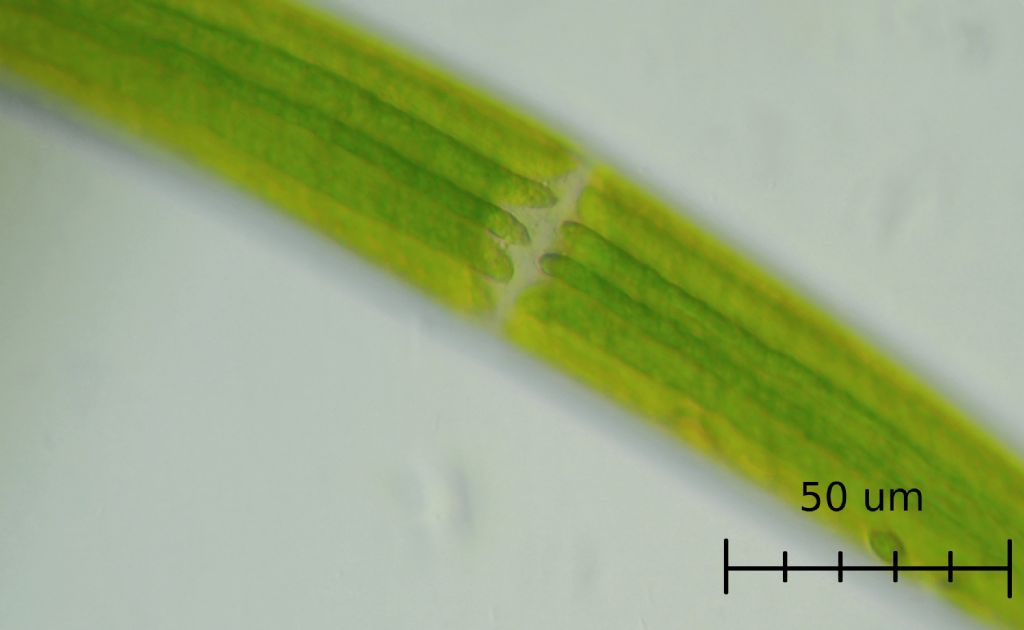 Closterium sp