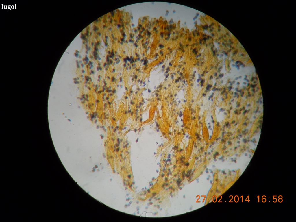 gloeocystidiellum SP (Gloeocystidiellum clavuligerum)