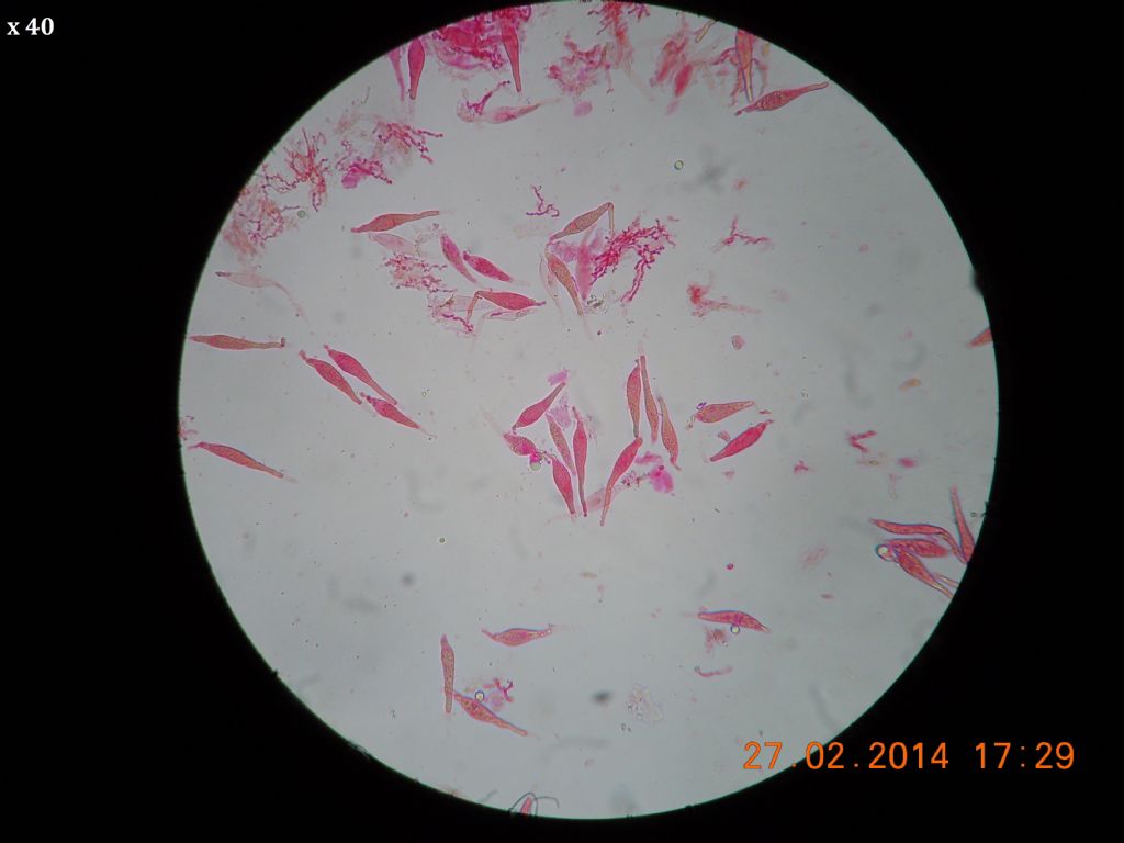 gloeocystidiellum SP (Gloeocystidiellum clavuligerum)