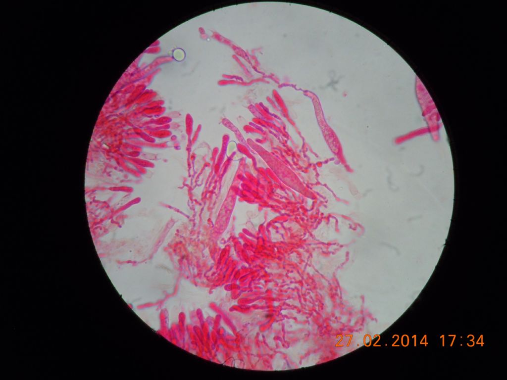 gloeocystidiellum SP (Gloeocystidiellum clavuligerum)