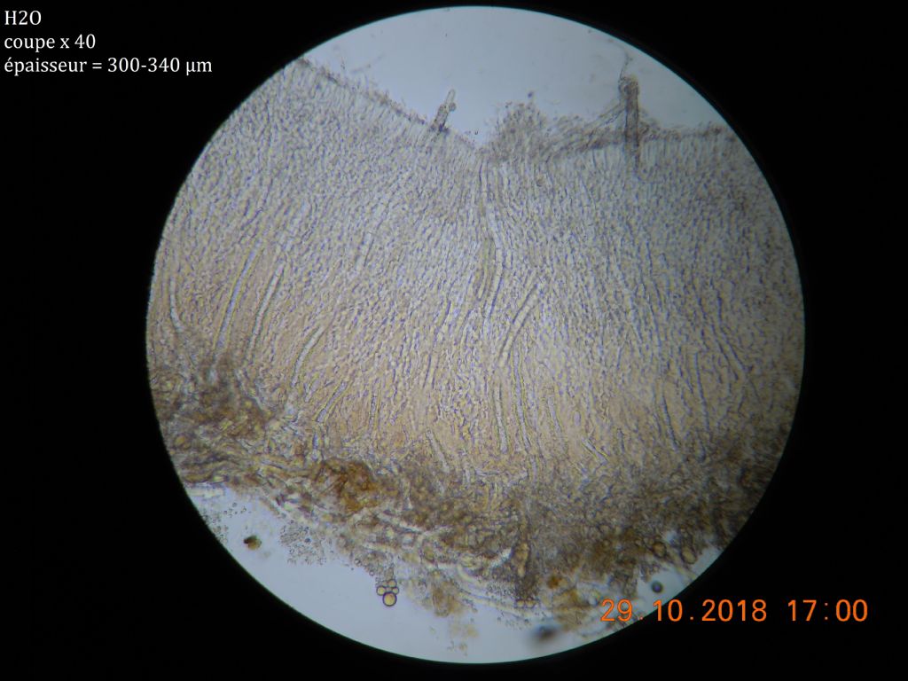 Scopulodes ? (Odonticium septocystidia)