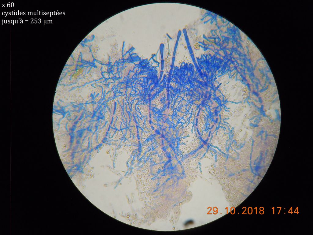 Scopulodes ? (Odonticium septocystidia)