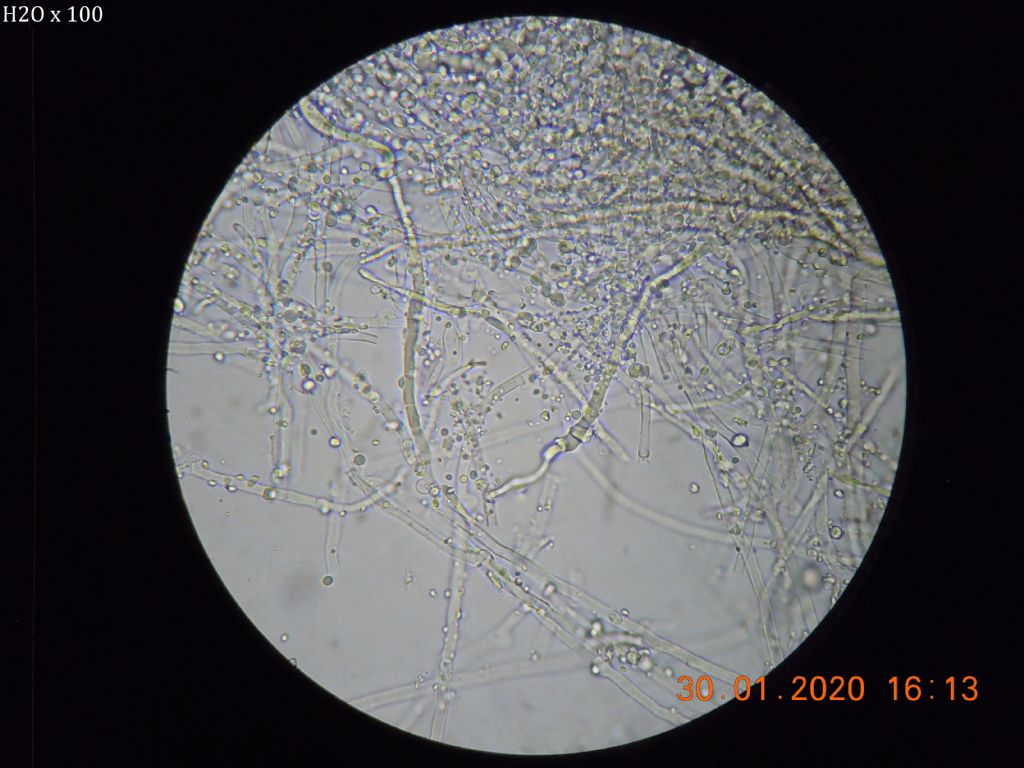 Sur Stereum (Intextomyces cystidiatus)