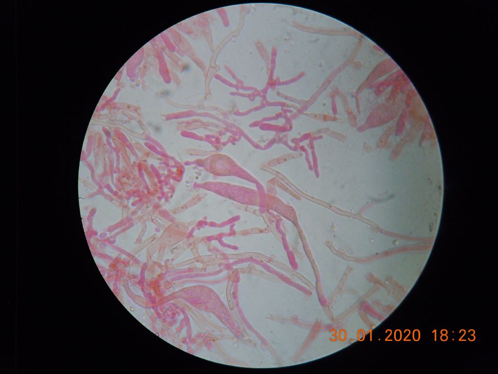 Sur Stereum (Intextomyces cystidiatus)