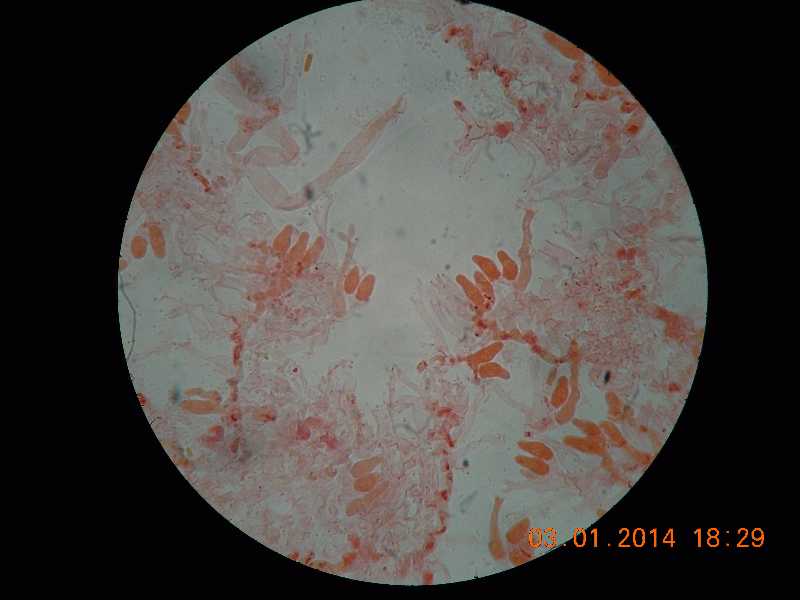 sistotrema (Sistotrema coroniferum)