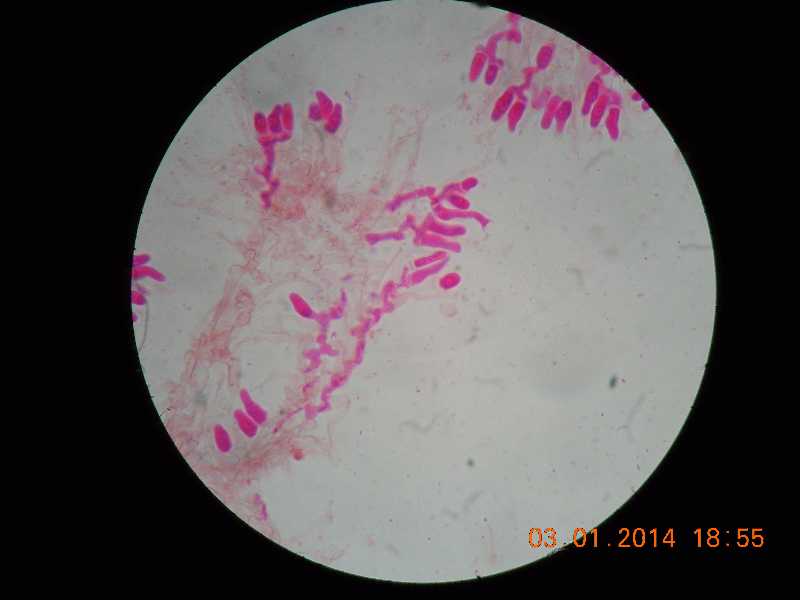sistotrema (Sistotrema coroniferum)