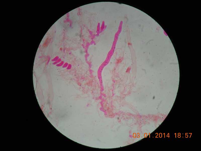 sistotrema (Sistotrema coroniferum)