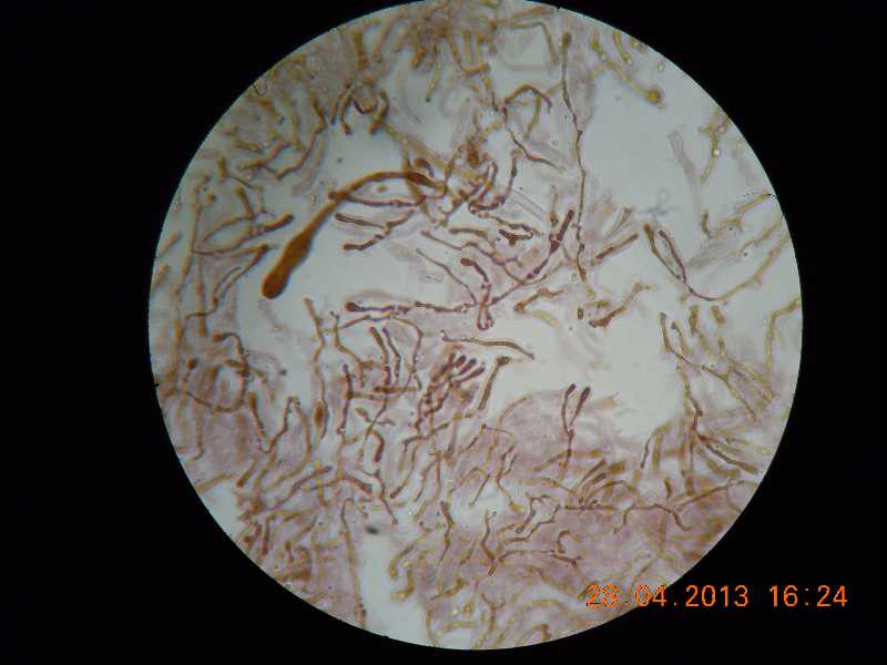 phlebia