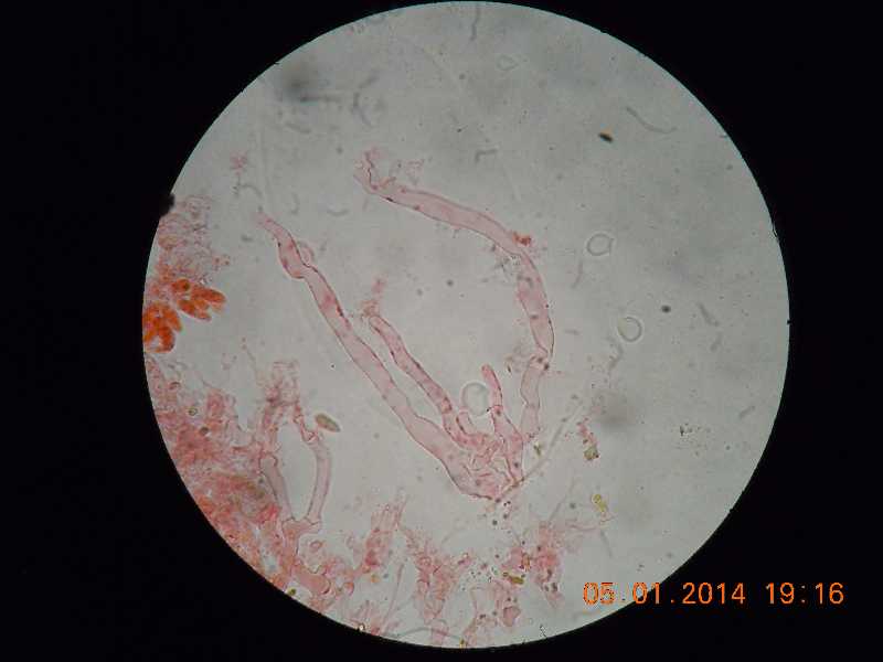 sistotrema (Sistotrema coroniferum)