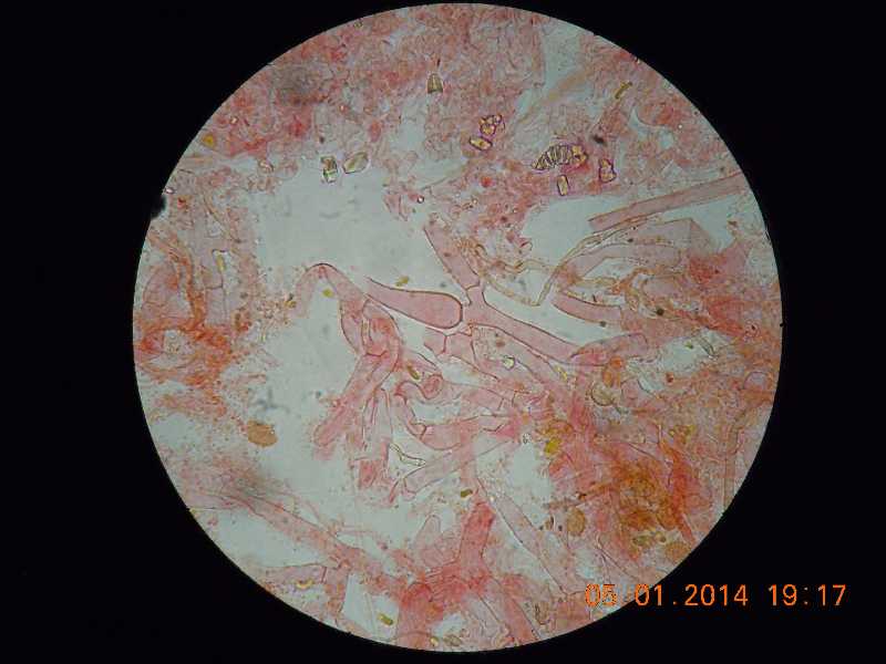 sistotrema (Sistotrema coroniferum)