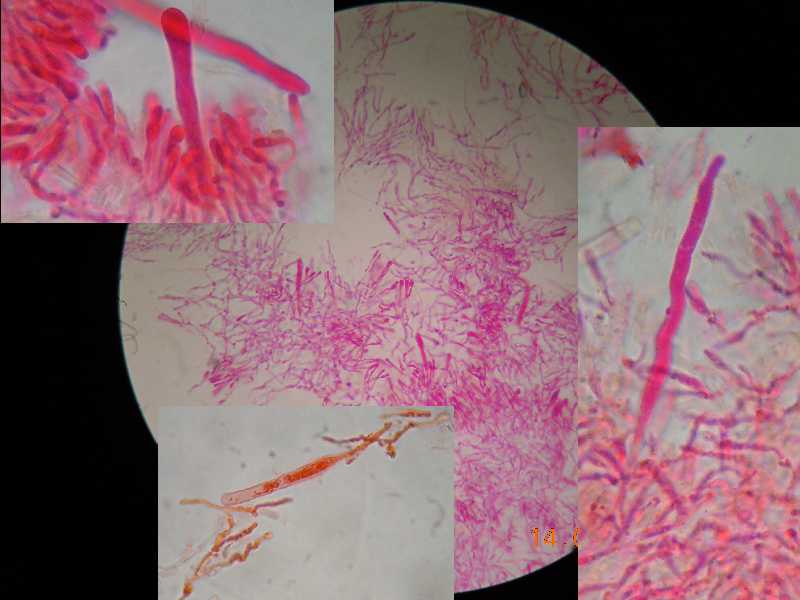 phlebioides1