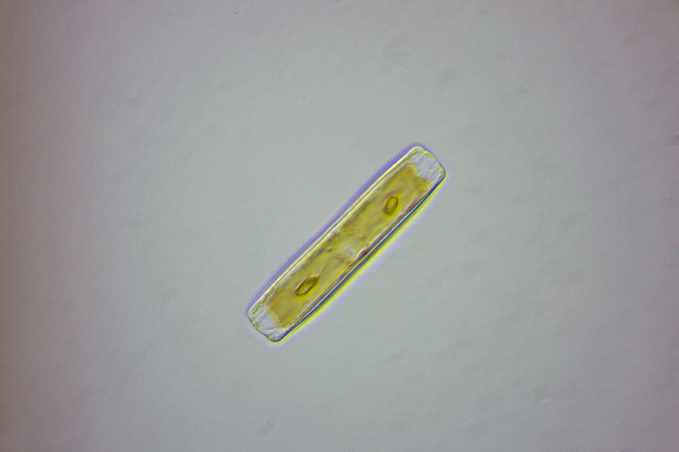 Un p di diatomee