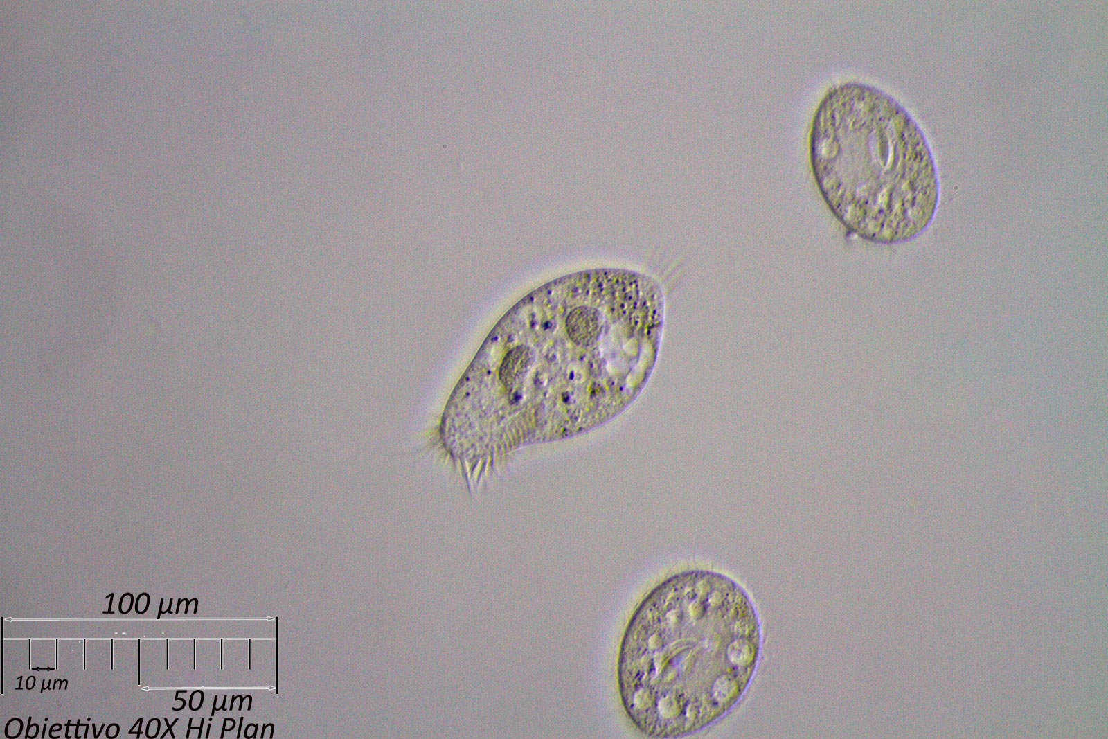 Ciliato 2