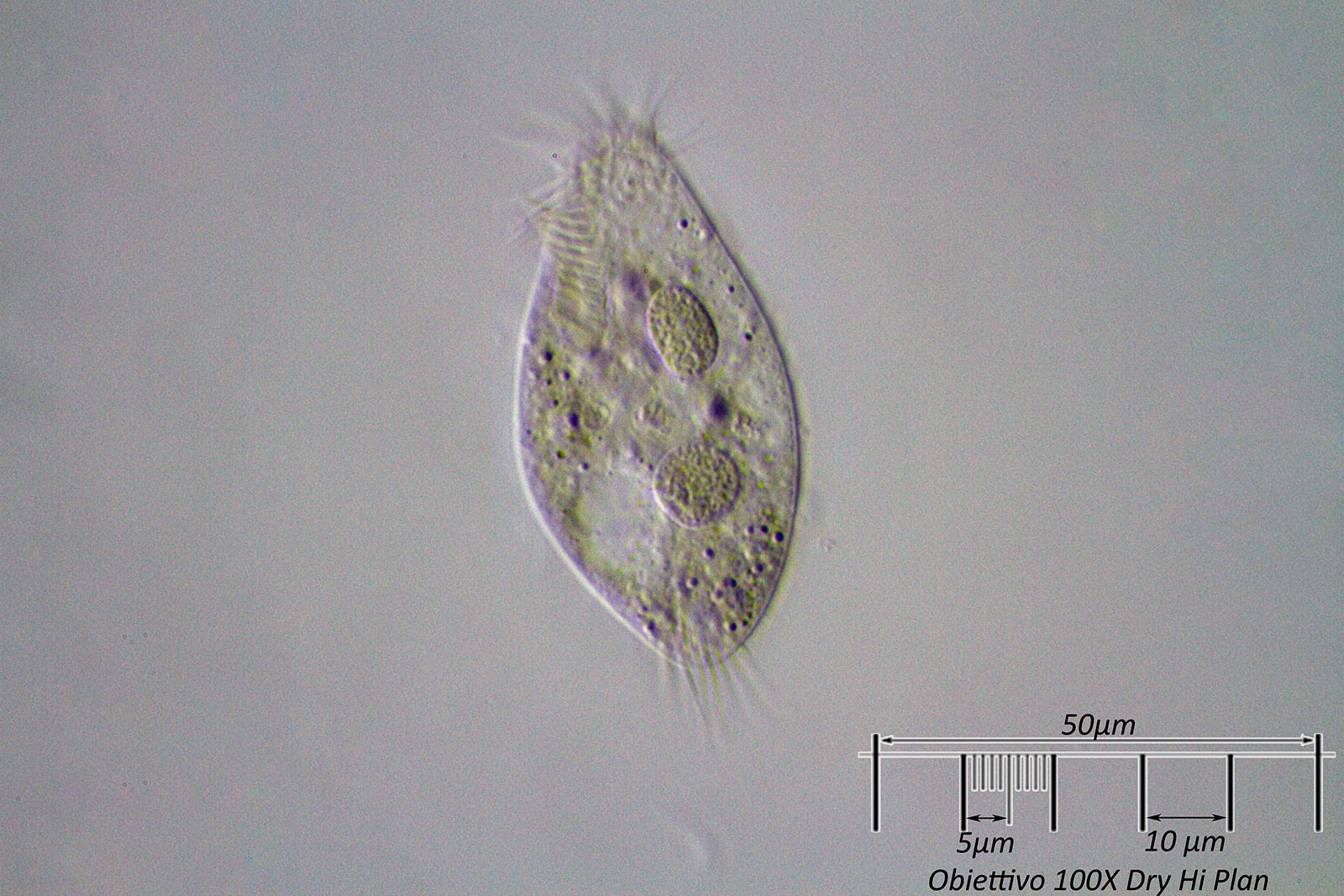 Ciliato 2